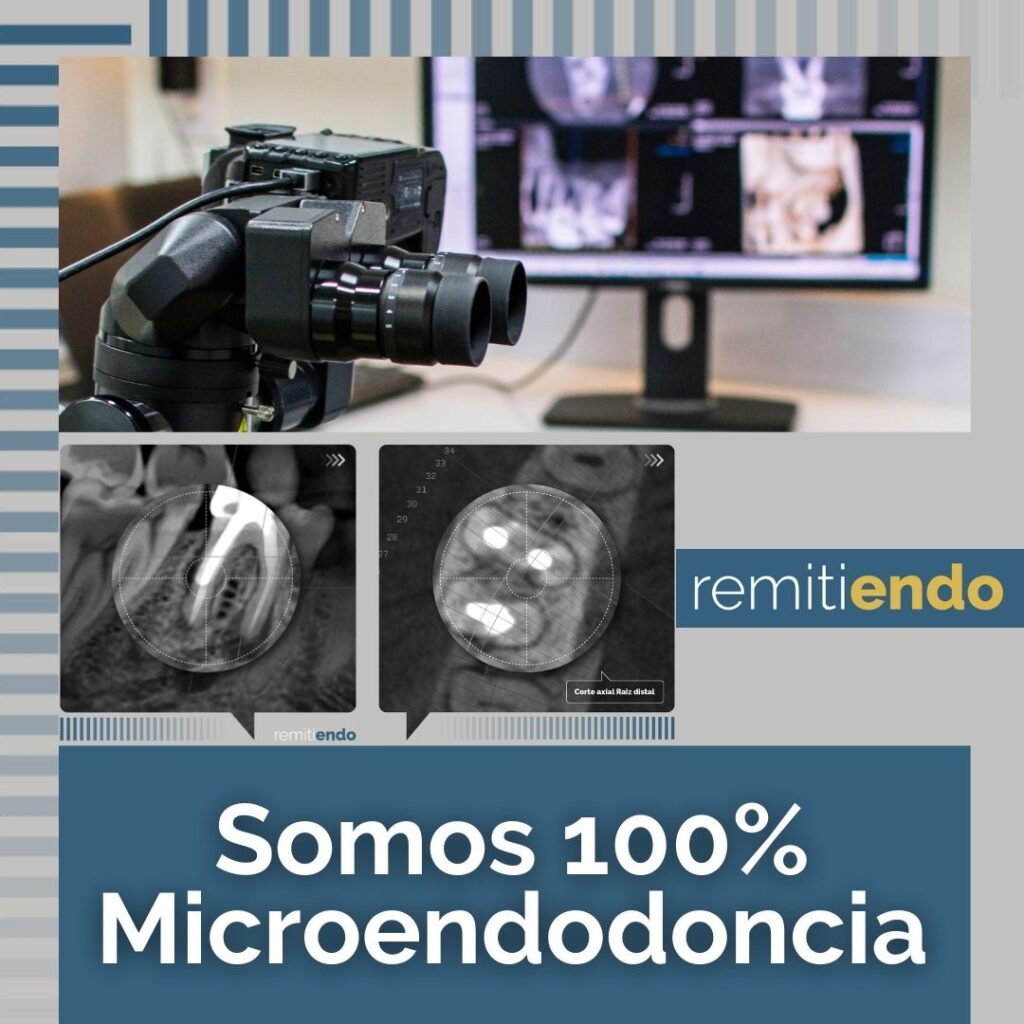 Beneficios dentistas remitiendo endodoncia