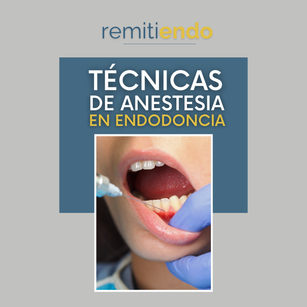 Técnicas de anestesia en endodoncia