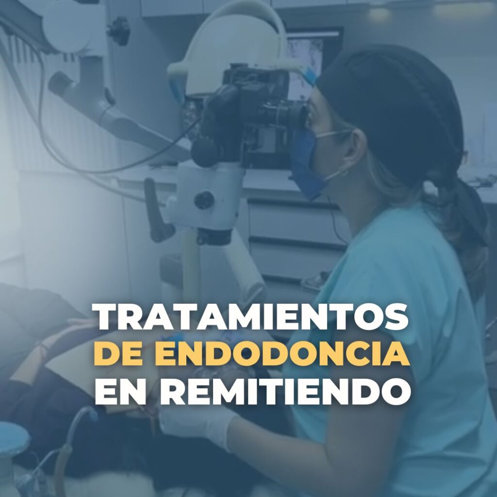 Tratamientos de Endodoncia en Remitiendo